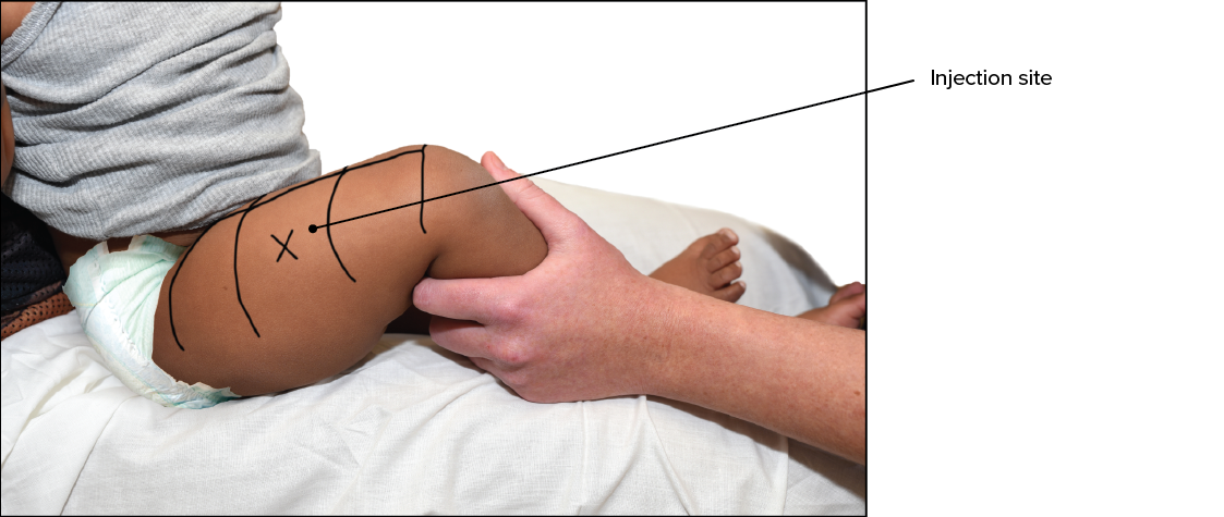 Påsætning af plaster 0-2 år